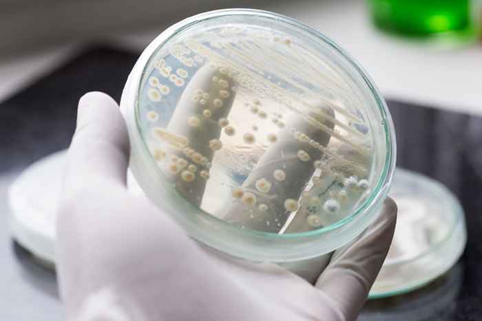 L'infezione fungina mortale si sta diffondendo rapidamente, afferma CDC, questi sono i fattori di rischio