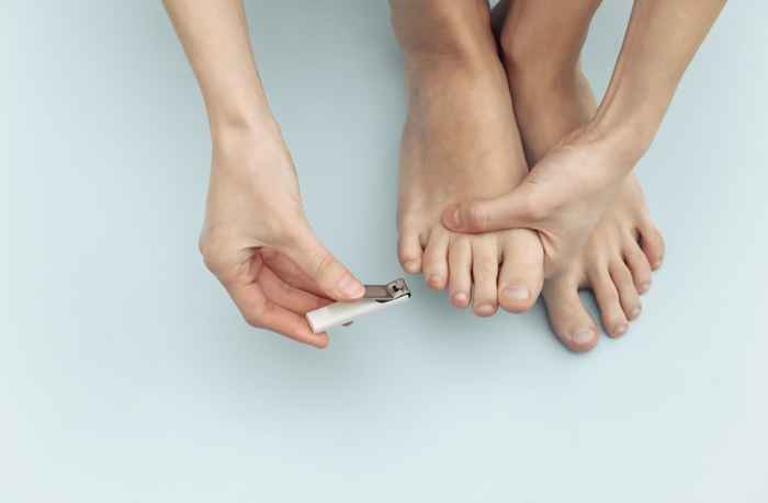 O que acontece se você não cortar as unhas dos pés por um mês, de acordo com os podólogos