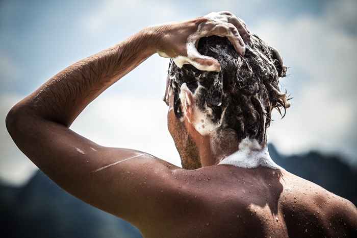 20 Motivi sorprendenti i tuoi capelli si stanno assottigliando