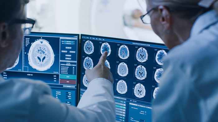 Se você notar isso com sua audiência, verifique se há um tumor cerebral