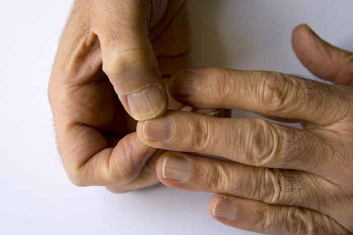 Si sus uñas se están rompiendo, podría carecer de este nutriente