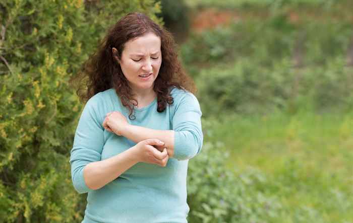 Nunca faça isso para combater os mosquitos, as autoridades locais alertam